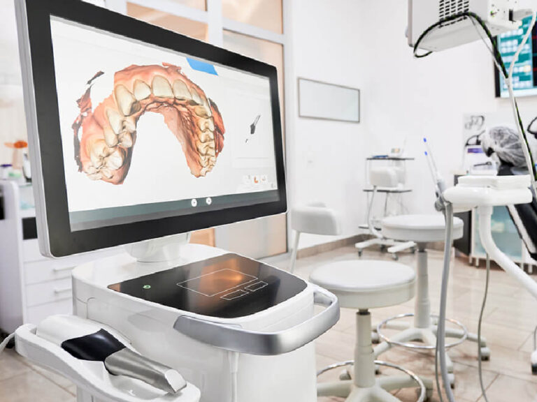 The image shows a modern dental office featuring a digital dental scanner and a computer screen displaying a 3D model of a dental arch.